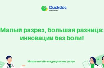 Иллюстрация технологии SMILE для лазерной коррекции зрения
