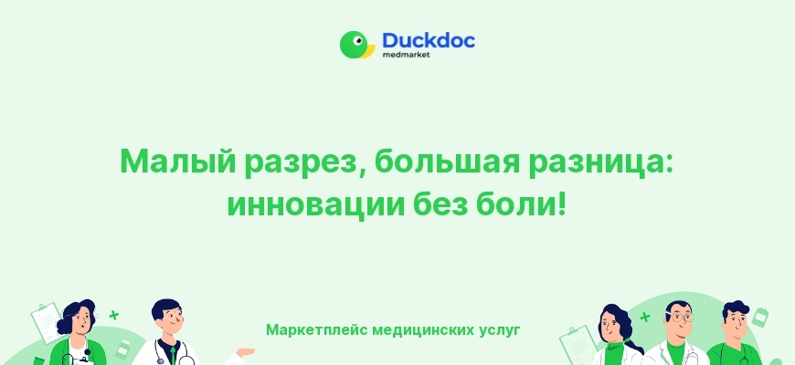 Иллюстрация технологии SMILE для лазерной коррекции зрения